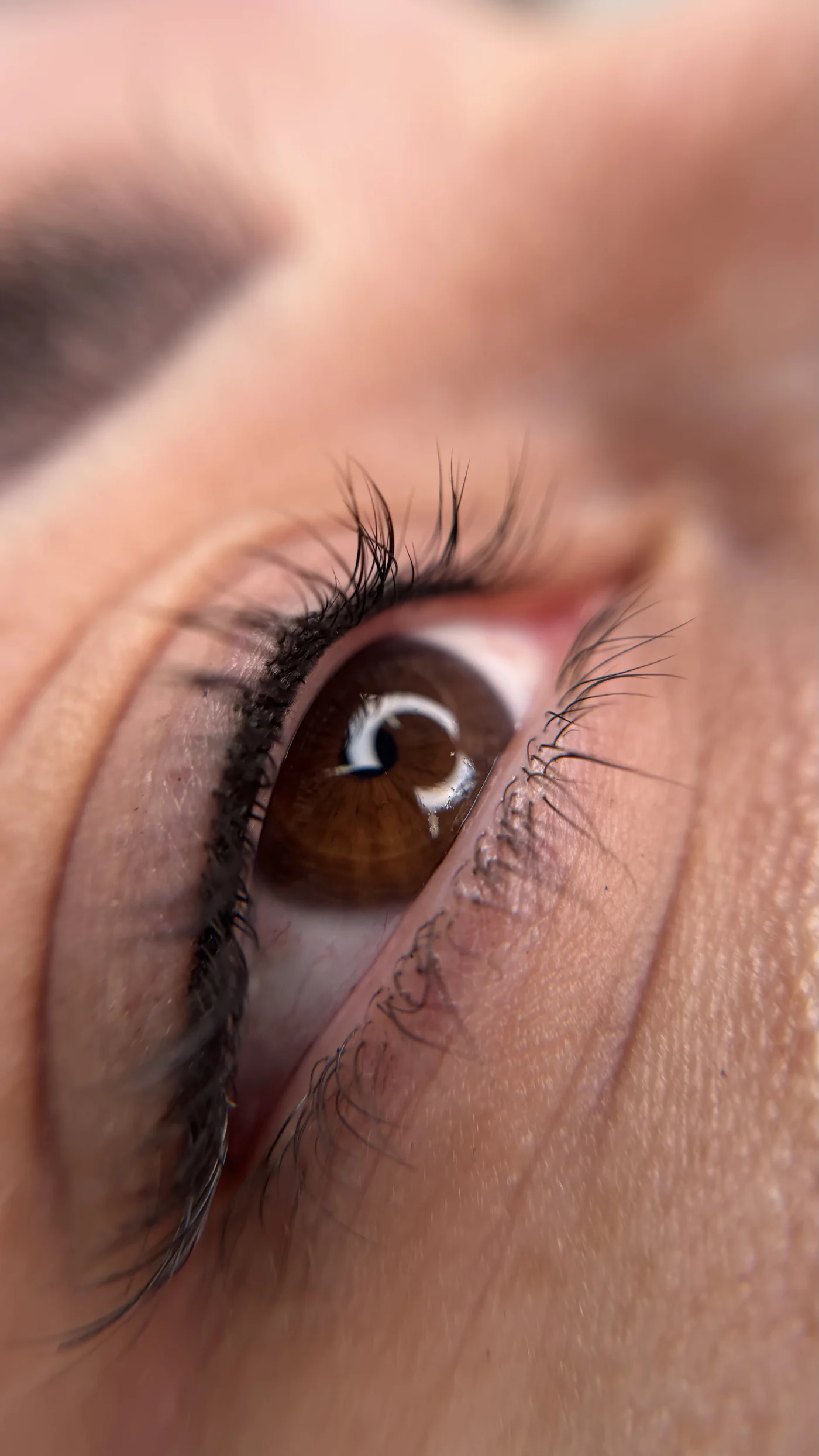 Wimpernkranzverdichtung in Hamburg, Ergebnis 2 von Natalie Demtschenko