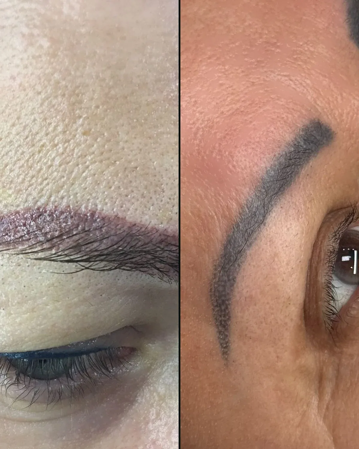 Zwei Augenbrauen mit altem Permanent Make-up: links eine Verfärbung, rechts eine sehr dichte Pigmentierung
