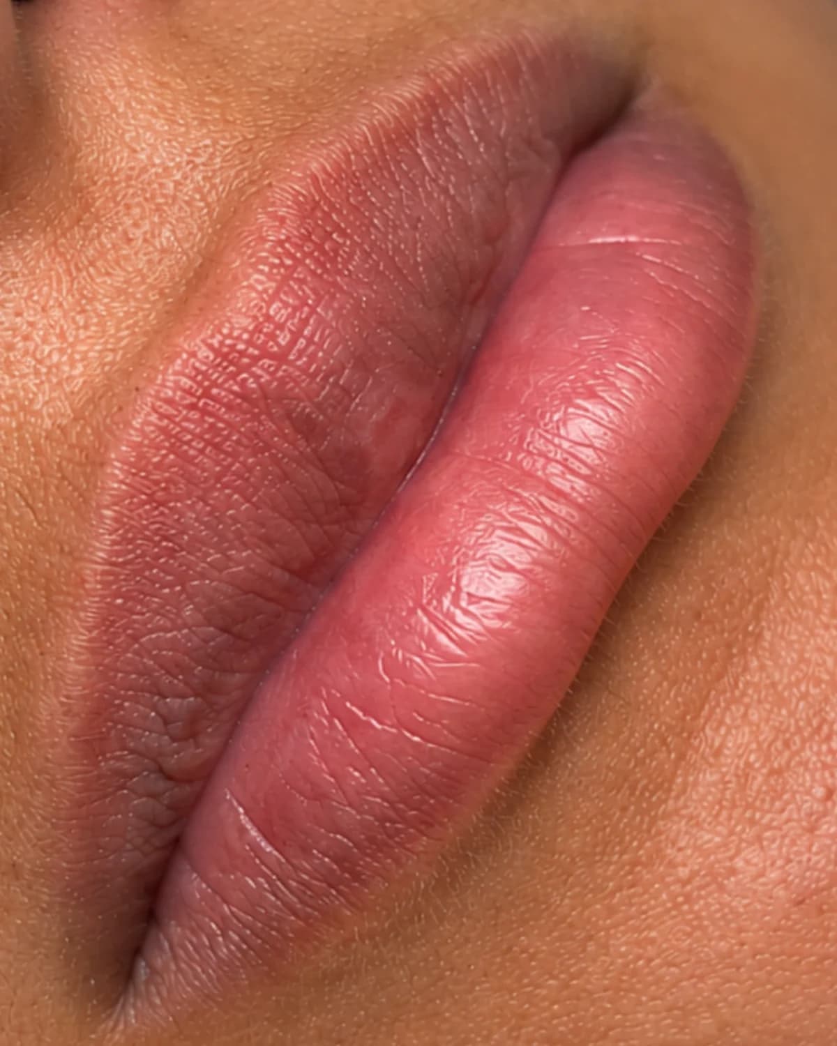 Lippen vorher, Beispiel 5