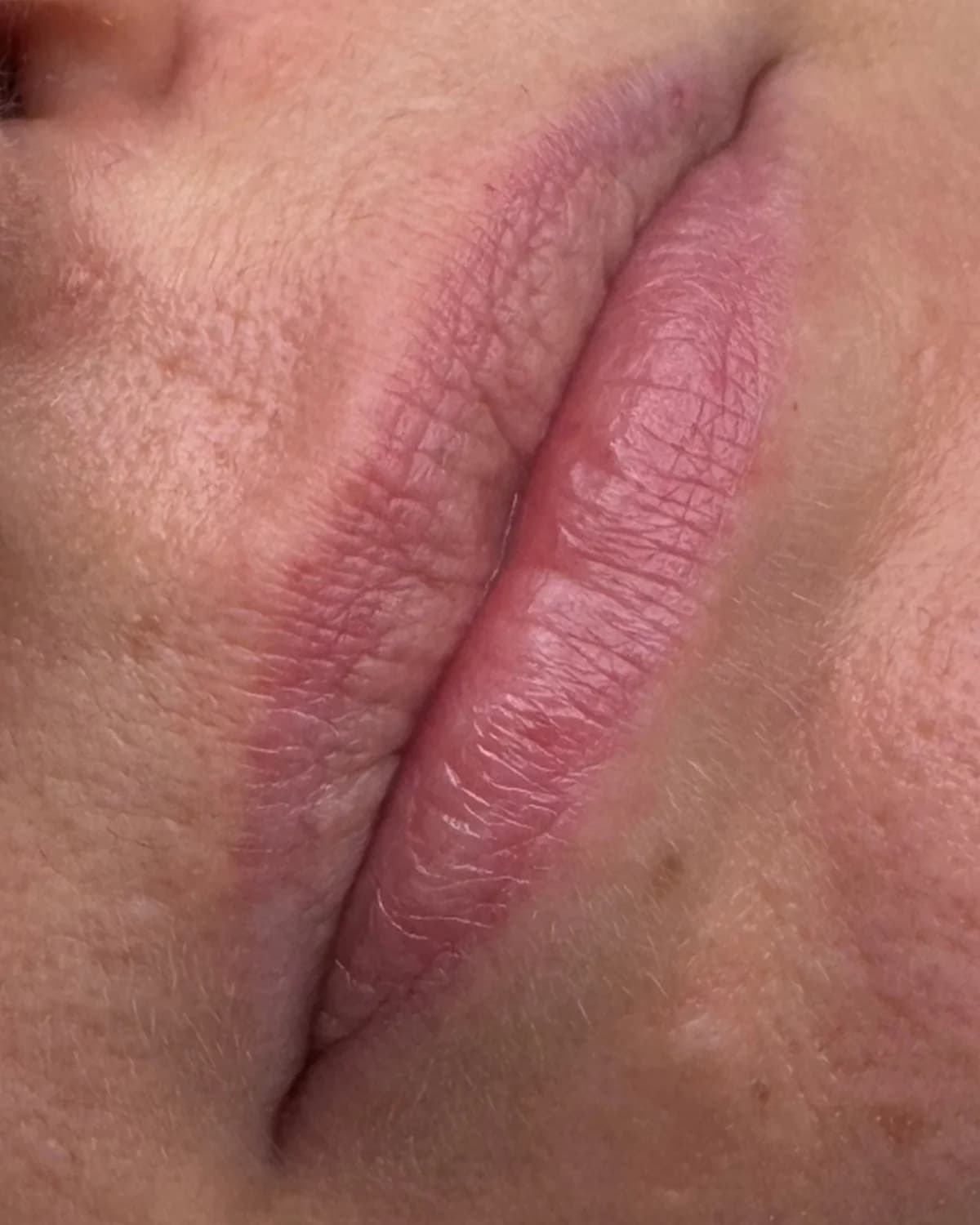 Lippen vorher, Beispiel 6