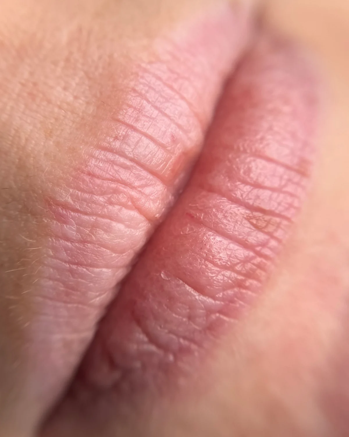 Lippen vorher, Beispiel 7